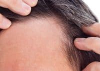 Spécialiste depuis 18 ans dans le traitement capillaire et les micro-greffes cheveux à Paris