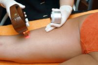 L&rsquo;épilation laser : la solution pour une épilation définitive !